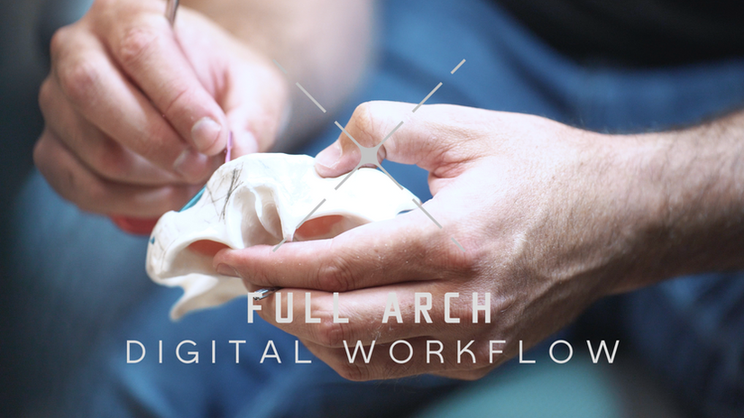 Full Arch Digital Workflow Course